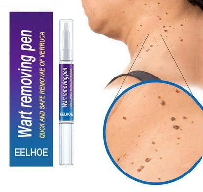 Wart Removal Pen, Removing Against Moles Pimple Patch Remove Black Dot
