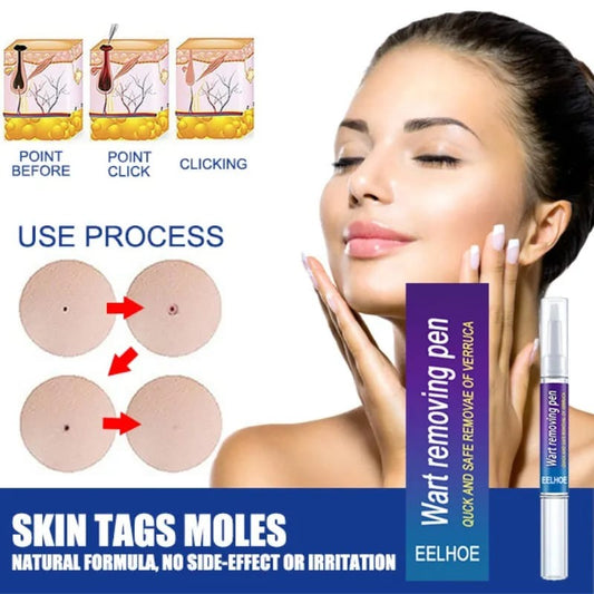 Wart Removal Pen, Removing Against Moles Pimple Patch Remove Black Dot